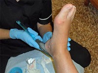 Anneliese Foot Health Care 696904 Image 1